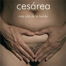 CESÁREA